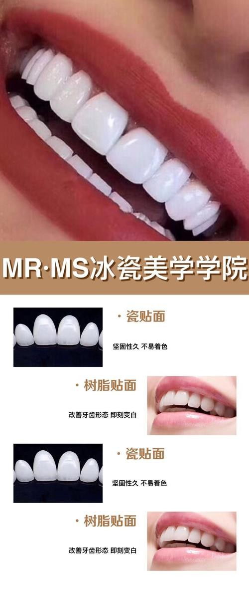 煙臺牙齒美白加盟機構師資力量雄厚2021