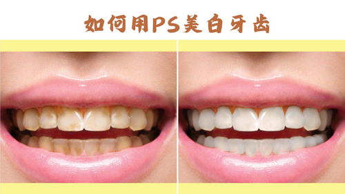 如何用PS美白牙齒