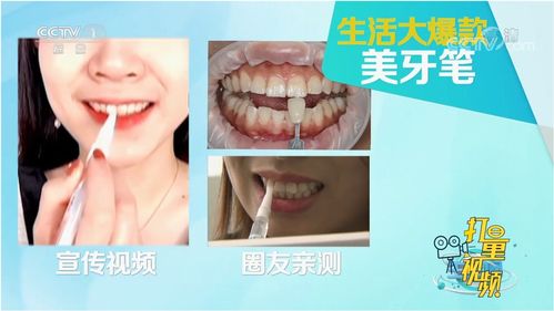 牙齒美白筆效果微弱,專家分享日常牙齒美白方法,快收藏