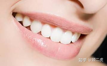口腔科臨床常見病癥之 牙齒發(fā)黃及治療
