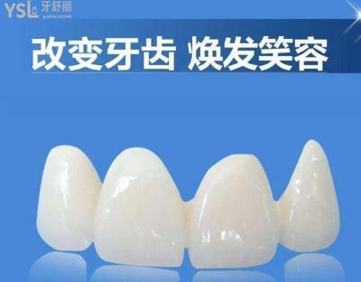 全瓷牙品牌排行榜及價格(哪個品牌質量好),進來了解就曉得了