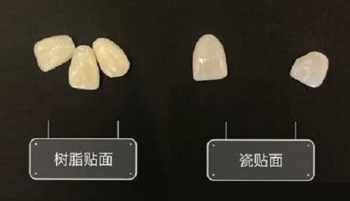 牙齒貼面發黃了怎么辦是哪些原因造成的呢可以洗牙嗎