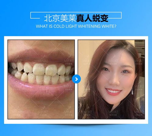 牙齒美白 牙齒白到飛起的秘密 皓齒美白 美麗從牙齒開始 讓笑容更加燦爛 綻放最美自信 悅美整形