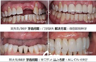陳國慶 個人主頁 合肥美奧口腔 美佳網