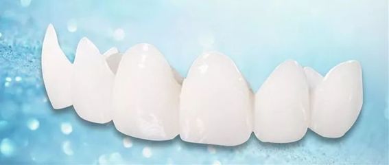 為什么口腔醫生向您推薦全瓷牙