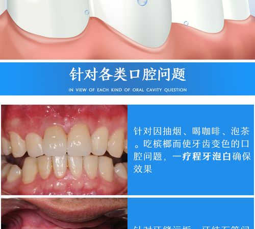 潔牙慕斯美白牙齒清新口氣脫色劑牙洗牙粉美白神器