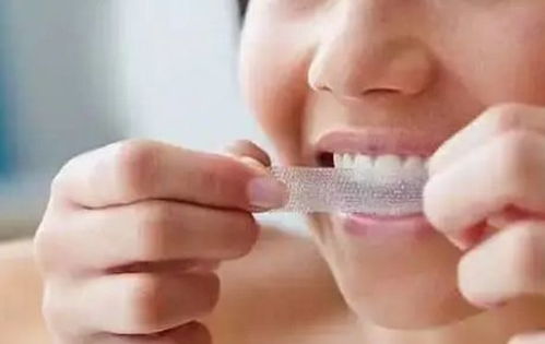 牙齒美白,哪些招最管用 哪些是瞎折騰