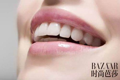 吳宣儀 牙齦笑 好甜 關于美牙你還得知道這些