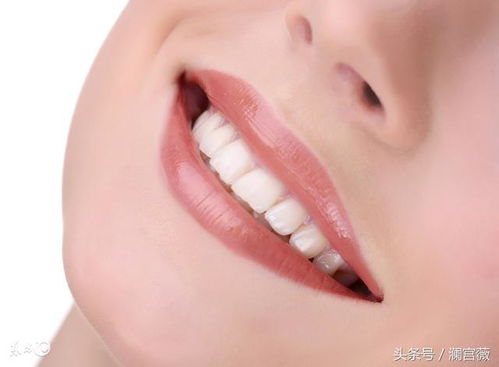 瀾宮薇 如何美白牙齒 從這幾個方法入手
