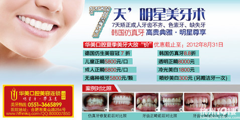 韓國仿真牙好嗎?-美顏健身區-杭州19樓
