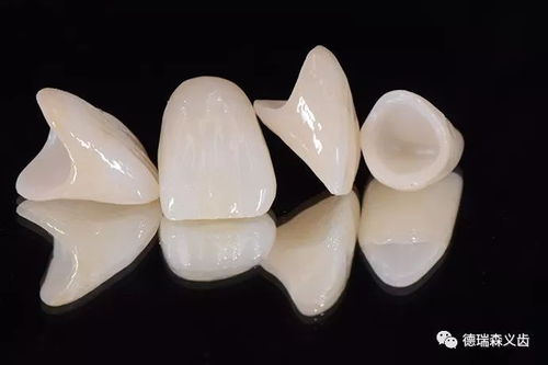 全瓷牙 牙齒修復的好材料
