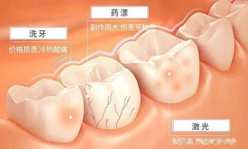 是什么 黑 科技護牙方式風靡全網 專業美白健齒,冷光牙貼成就一瞬亮白