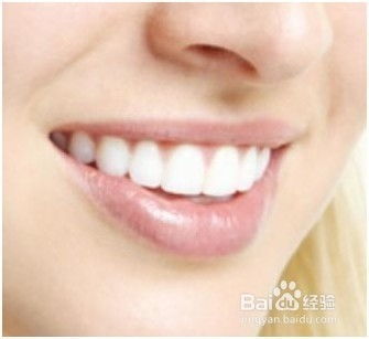 洗牙后要注意的問題有哪些