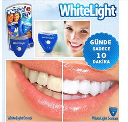 whitelight潔牙儀 冷光牙齒美白儀 牙齒潔白器