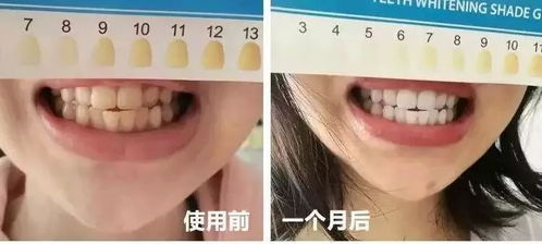 好物 牙齒不夠白,再美都不自信 牙膏