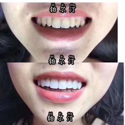 鉑爾汀 2019年9月精品小班牙齒美容課程結束,學員們順利畢業