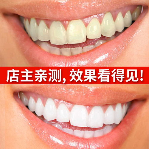 美白神器 去黃去漬去口臭潔牙粉洗漱口水牙粉慕斯牙膏