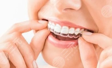 矯正牙收費價目表,原來矯正[換頭]是真的!