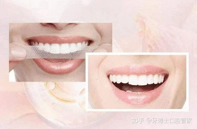 深圳3d美牙貼面怎么收費|醫生|牙齒|美容|深圳市_網易訂閱