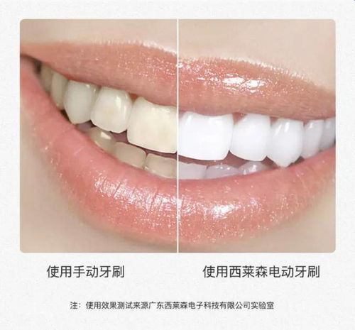 這樣刷牙,牙齒更美白,口腔更健康