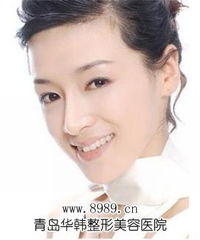 瑞蘭玻尿酸注射除皺怎么樣