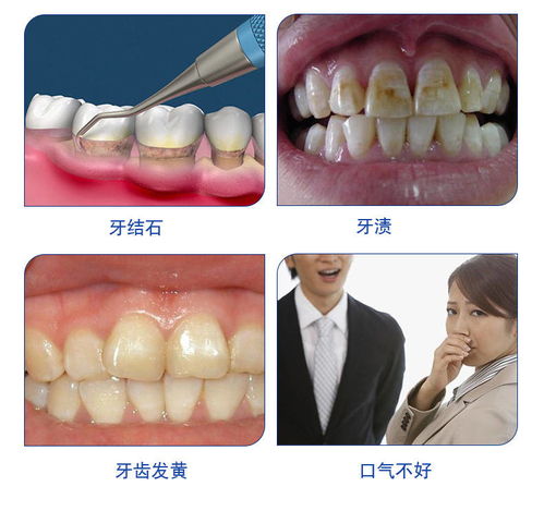 牙博士草本美白牙膏清潔口腔減輕牙漬潔齒薄荷牙膏