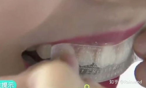 美白牙齒的牙貼,真的能夠使我們的牙齒變白嗎